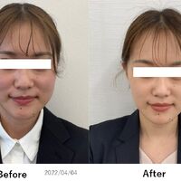 画像2553：基礎化粧品を使用したBefore＆After