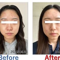 画像2554：基礎化粧品を使用したBefore＆After