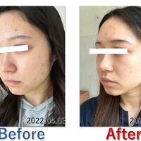 画像2555：基礎化粧品を使用したBefore＆After