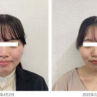 画像2556：基礎化粧品を使用したBefore＆After