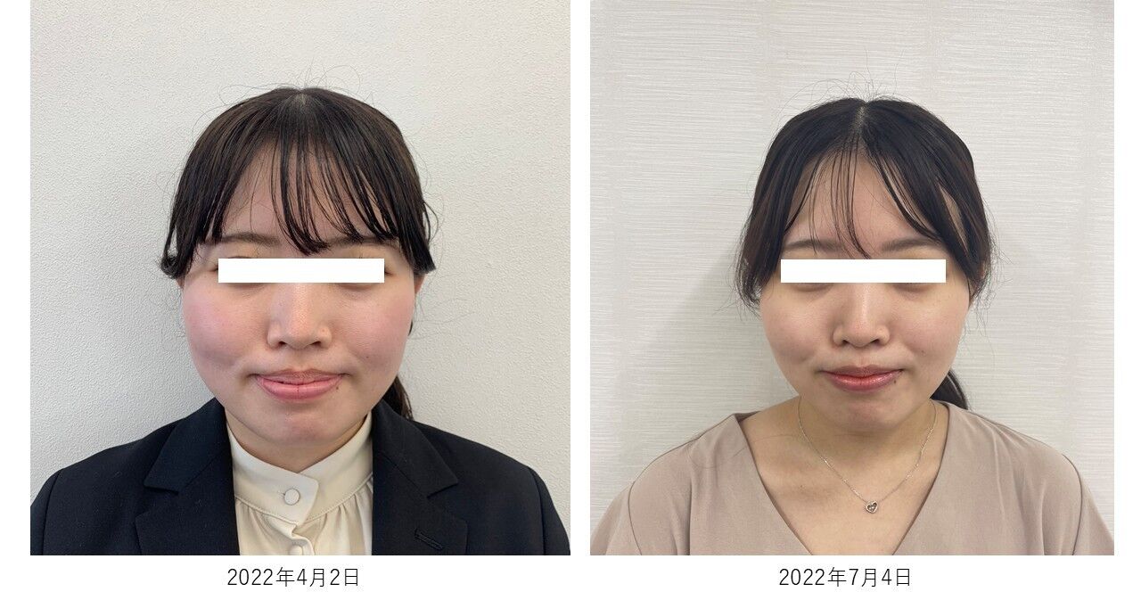 基礎化粧品を使用したBefore＆After