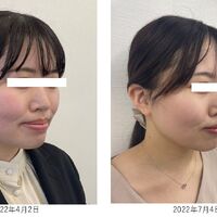 画像2557：基礎化粧品を使用したBefore＆After