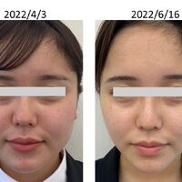画像2558：基礎化粧品を使用したBefore＆After