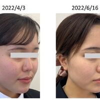 画像2559：基礎化粧品を使用したBefore＆After
